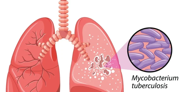 ޓީބީ ދުވަސް 2025